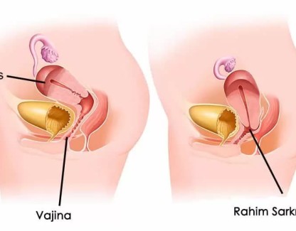 Rahim Sarkması Nedir