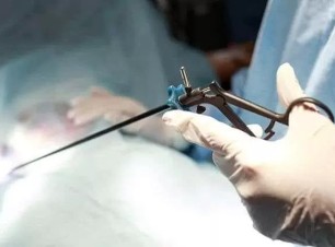 Laparoskopik Ameliyatlar