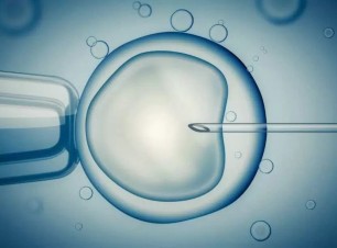 Ivf Yöntemleri